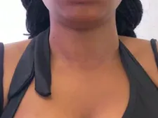 ThickAura 40